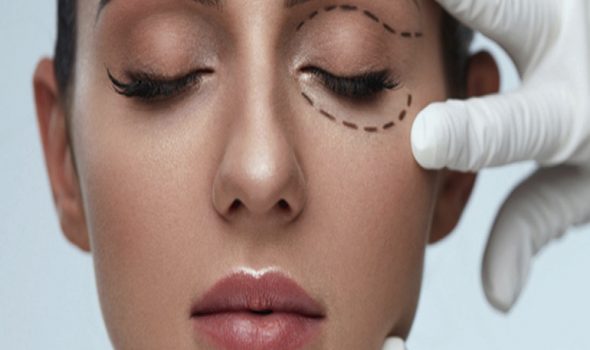 imagen de Blefaroplastia cirugia estetica facial clinica renacimiento