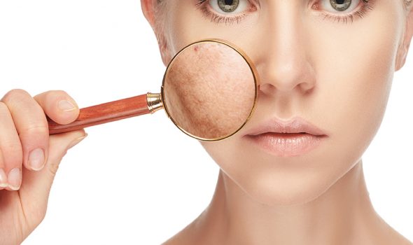 image du traitement localisé clinique renacimiento madrid et marbella esthétique du visage