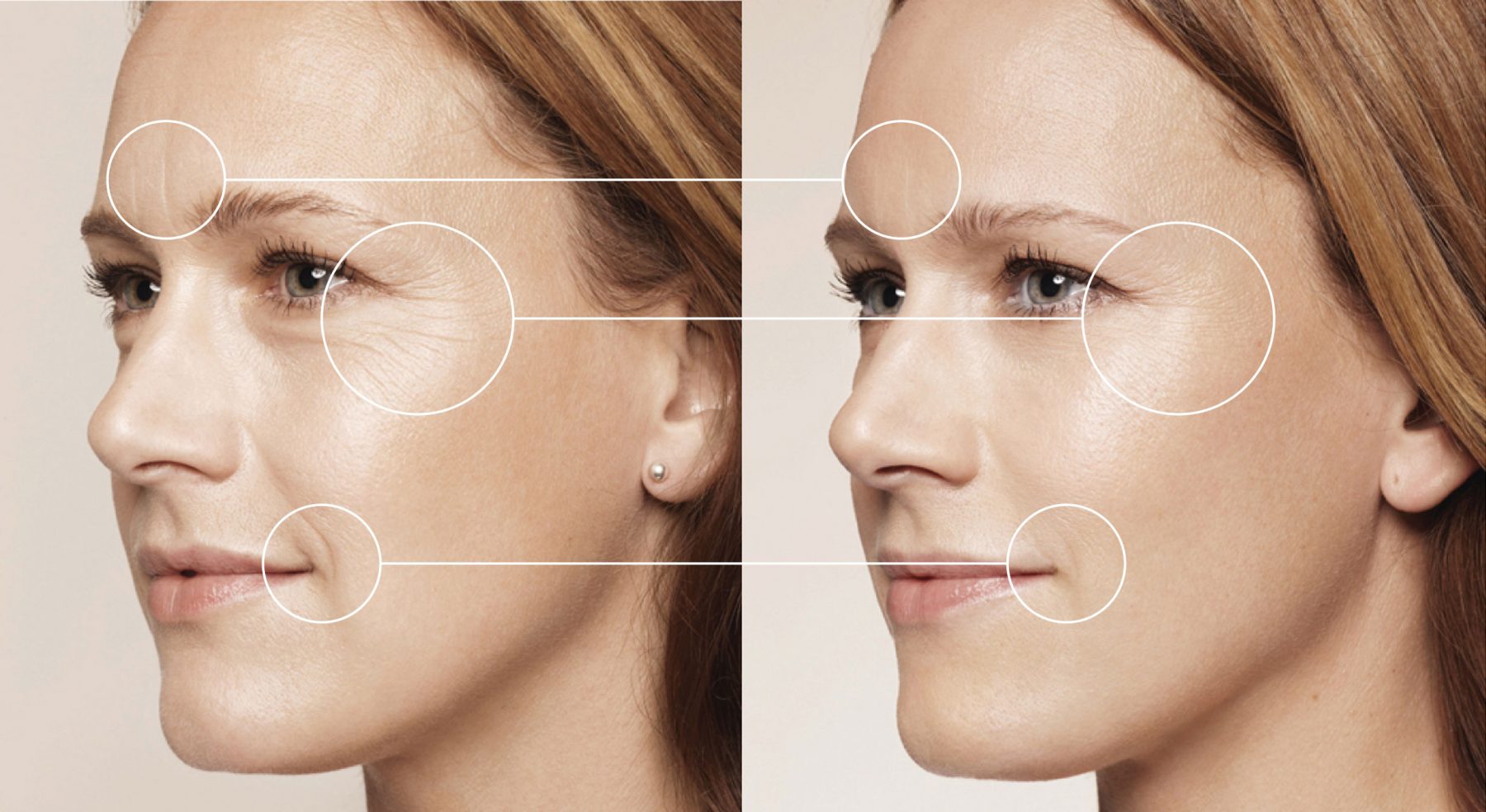 volume-facial-image-clinica-renacimiento-madrid-marbella-scaled.jpg